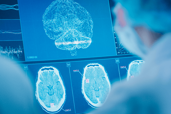 A clinician observes neurofeedback results